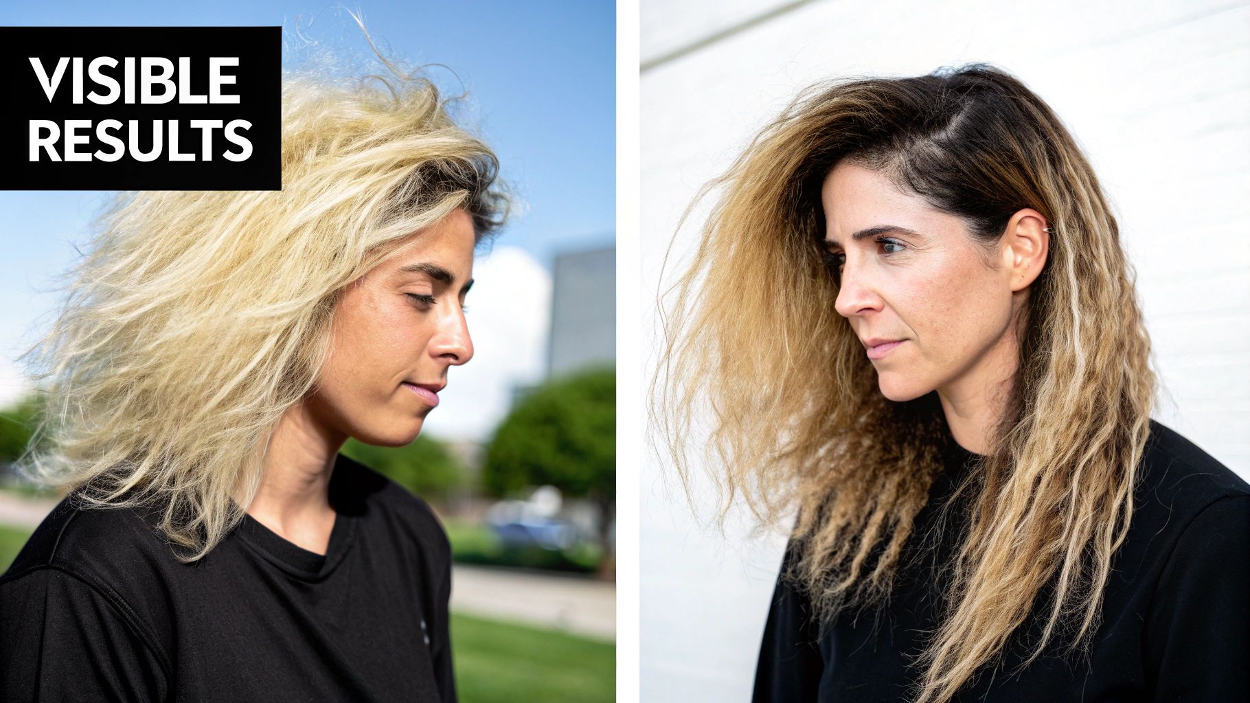 Depiction of PRP injection for hair.